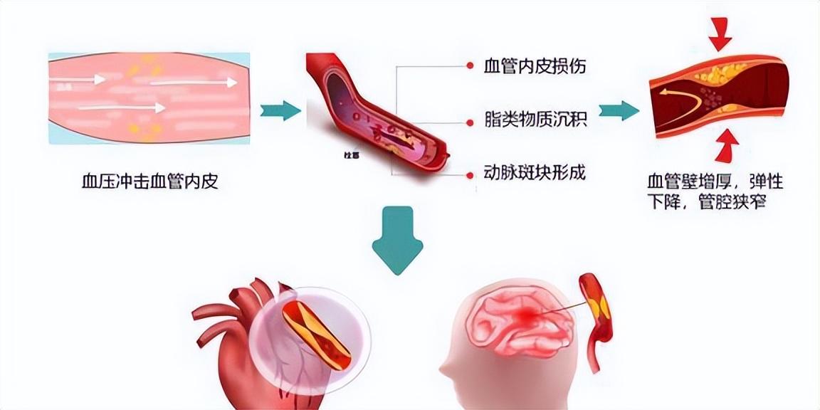 最新男性口服药物，重塑健康格局的新选择